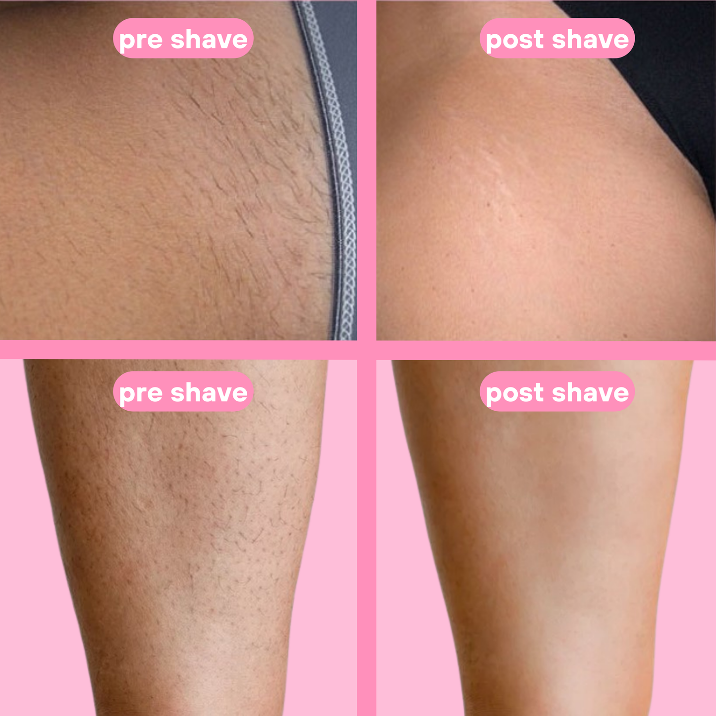 Livora® Bikini Shaver