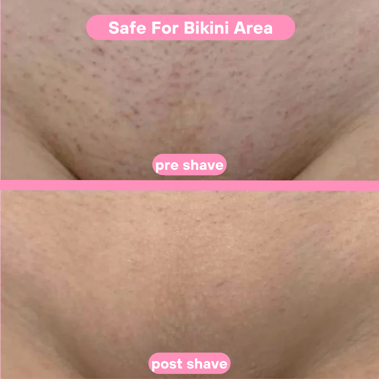Livora® Bikini Shaver