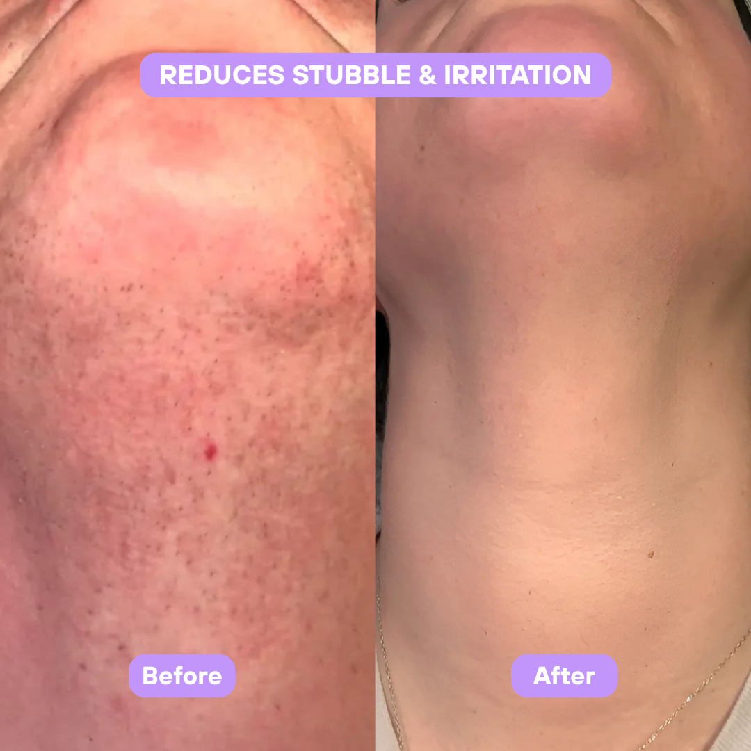 Livora® Cyperus Rotundus Skin Serum