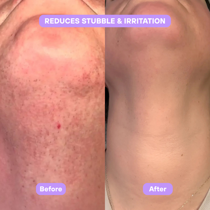 Livora® Cyperus Rotundus Skin Serum