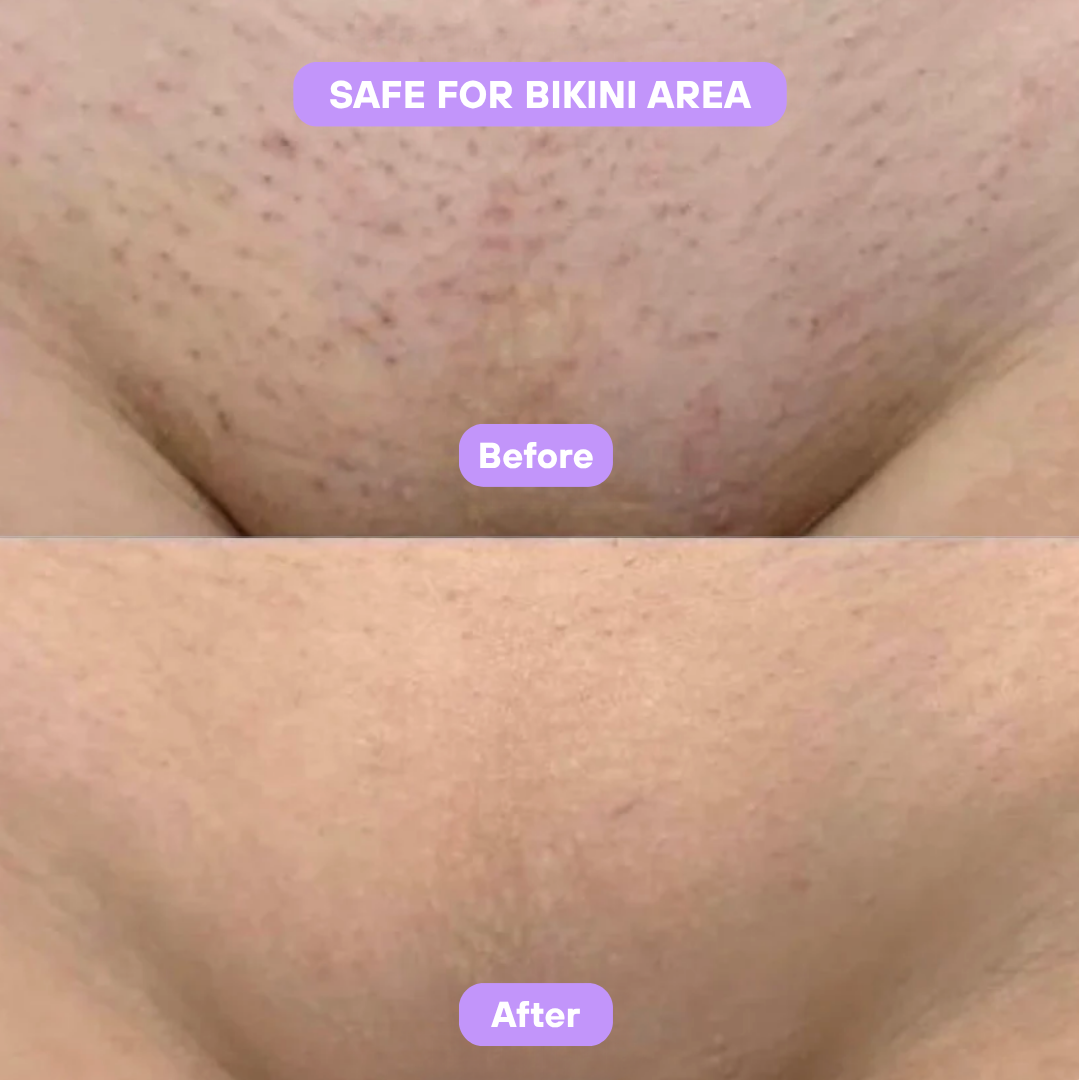 Livora® Cyperus Rotundus Skin Serum