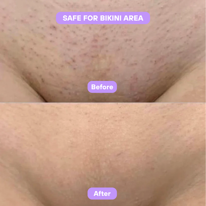 Livora® Cyperus Rotundus Skin Serum