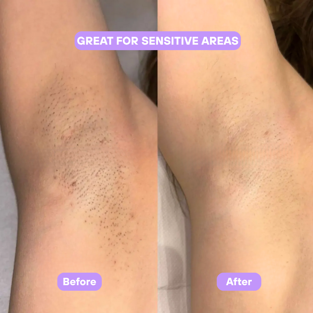 Livora® Cyperus Rotundus Skin Serum