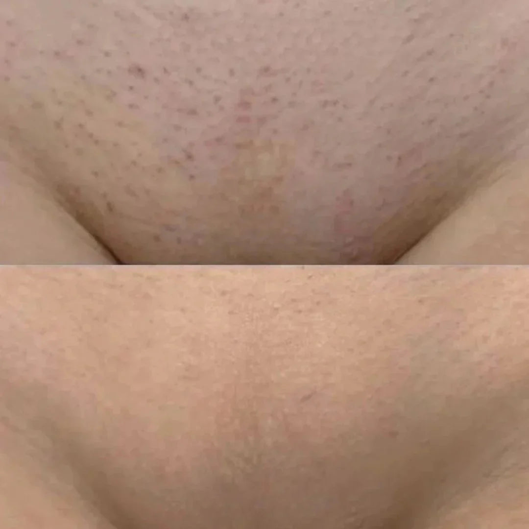 Rotary for smooth delicates
